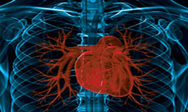 x-ray image of the heart
