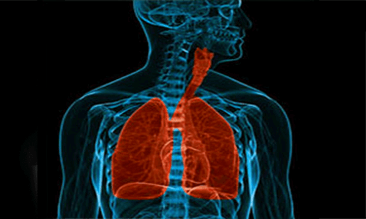 x-ray image of lungs